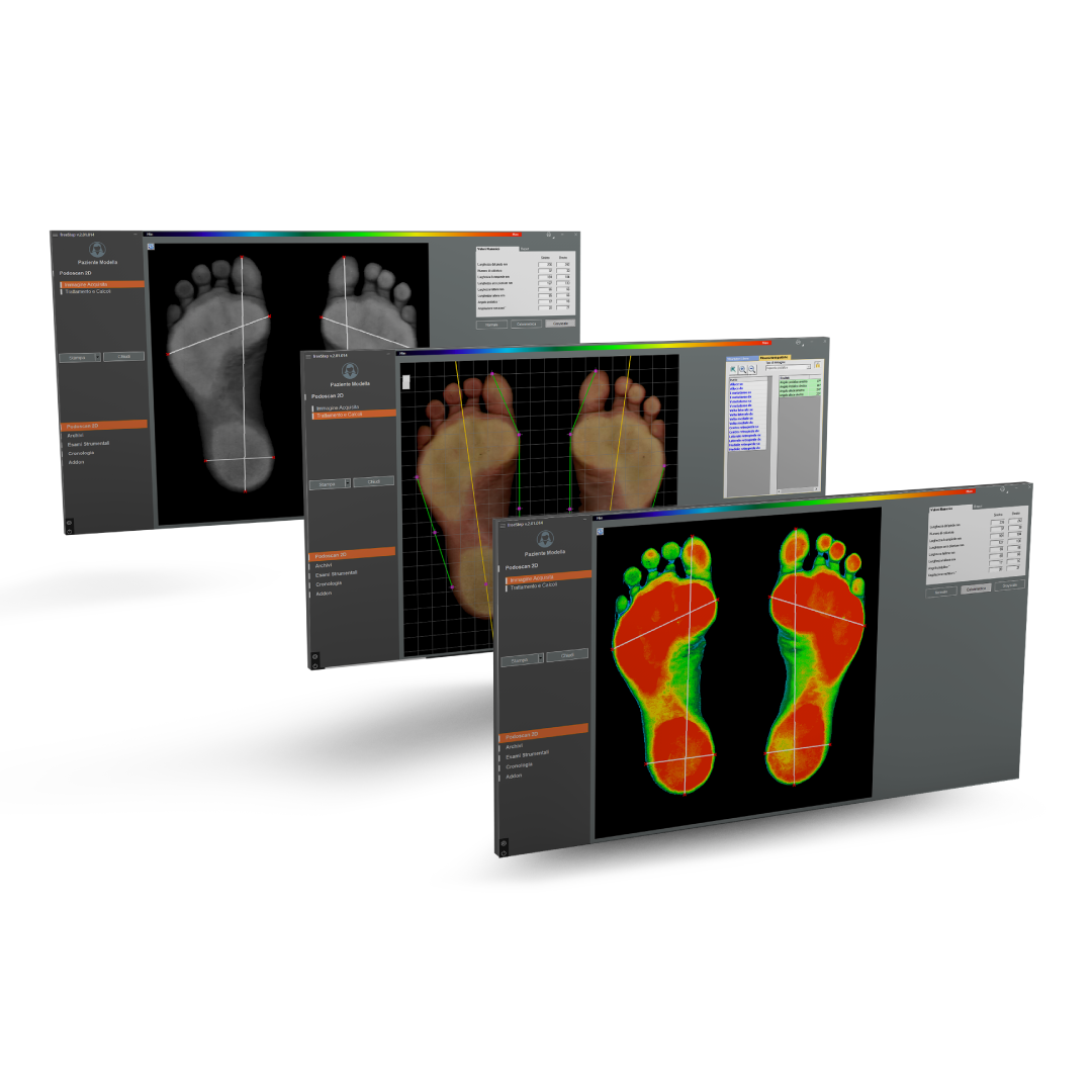 FS_PODOSCAN3D-copia-2.png